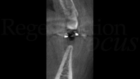 4. Sezione CBCT.
